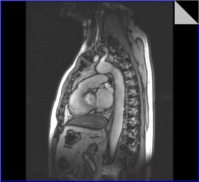 interventi di alta chirurgia cardiaca - CARDIOLOGO AMICO