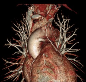 PENSA ALLA TUA VITA, FAI IL CHECK UP DEL CUORE PERIODICAMENTE - CARDIOLOGO AMICO