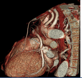 MONITORAGGIO della PRESSIONE ARTERIOSA  24 ore - ELETTROCARDIOGRAMMA A DOMICILIO - CARDIOLOGO AMICO